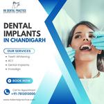 RK Dental Practice – Dr. Puneet Jindal (BDS | MDS) - photo 3