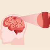 Best Neurointerventional Surgeon in Saket | Dr Devasheesh Kamra - Health & Medical in Delhi