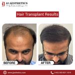 Jj hair transplant clinic in Islamabad - photo 2
