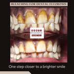 Sakti Dental & Orthodontic Clinic Tirunelveli - photo 5