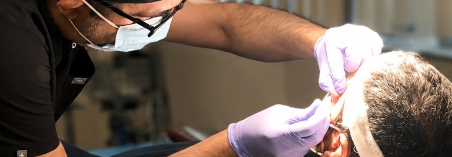 Beverly Hills Hair Restoration