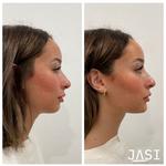 JASI Skin + Wellness Med Spa - photo 1