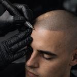 Toronto Scalp Micropigmentation Studio - photo 1