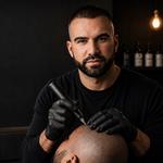 Toronto Scalp Micropigmentation Studio - photo 2