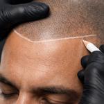 Toronto Scalp Micropigmentation Studio - photo 3