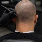Toronto Scalp Micropigmentation Studio - photo 8