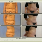 Michael Zarrabi MD - Plastic Surgeon - photo 1