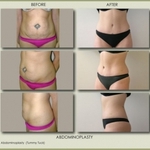 Michael Zarrabi MD - Plastic Surgeon - photo 2