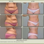 Michael Zarrabi MD - Plastic Surgeon - photo 4