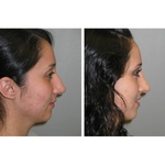 Lloyd Krieger MD - photo 5