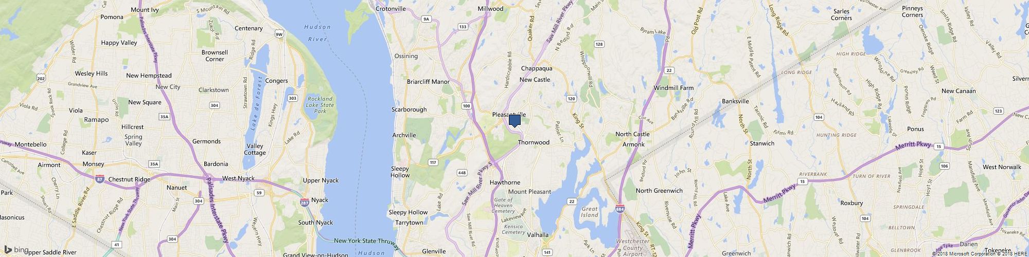 Kiss Laser Hair cover photo