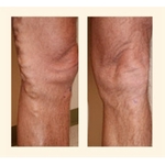 Northwest Vein Center - photo 4