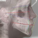 Medical Simulations Tech - Other in Ozone