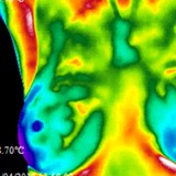 De Novo Scan, Clinical Thermography - Alternative Medicine in Scottsdale