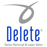 Delete Tattoo Removal & Laser Salon