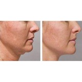 Phoenix Laser & Rejuvenation Center - Medical Centers in Phoenix