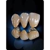 Alliance Dental Studio - Dental Technicians/Dentures/Implants in Scottsdale