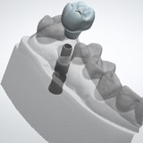 Dentek Dental Laboratory - Dental Technicians/Dentures/Implants in Scottsdale