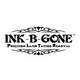 Ink-B-Gone - Tattoo in Denver