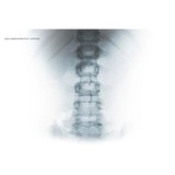 Lee Chiropractic Center - Chiropractors in Westminster