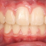 Vaughn A Johnson Pc - Dentists in Durango