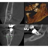 Endodontics - Dentists in New Haven