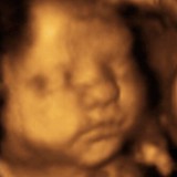 Image of A Miracle - Commercial Photography in Columbus