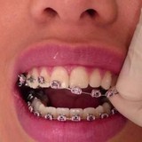 Heller Orthodontics - Dentists in Bethesda