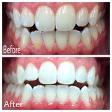 Lakebrink Dental - Dentists in Liberty