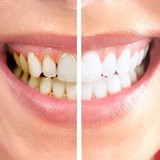 Callan D. White, DDS, PLLC - Dentists in Asheville