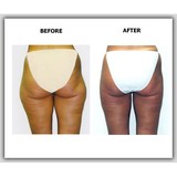 New Jersey Vein & Cosmetic Surgery Center - Plastic Surgeons in Red Bank