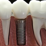 Hook Dov DDS - Dentists in Denville