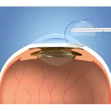 Oakwood Optical - Ophthalmologists in Dayton