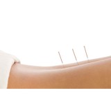 Points Of Health Acupuncture LLC - Acupuncture in Portland