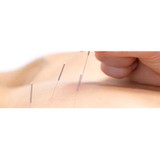 Nova Pain & Rehab Center - Chiropractors in Arlington