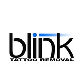 Blink Tattoo Removal - Tattoo Removal in Seattle