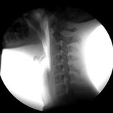 Bellevue Chiropractic Group - Chiropractors in Bellevue