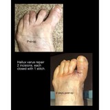 Bellingham Foot Care Center - Medical Equipment  & Appliances in Bellingham