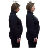 Aberle Chiropractic Clinic - Chiropractors in Madison