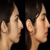 The Keyes Surgery Center - Plastic Surgeons in West Hollywood