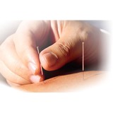 Hyatt Acupuncture - Acupuncture in Santa Monica
