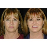 T.Y. Steven Ip, M.D., F.A.C.S. - Plastic Surgeons in Newport Beach