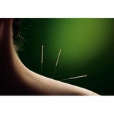 Awaken Balance - Acupuncture in San Diego