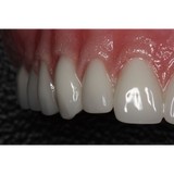 Grillo Miguel A DDS - Oral & Maxillofacial Surgeons in San Diego