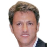 Extreme Smile Makeover - Dentists in San Diego