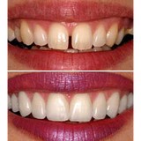 EZ Smile Family Dental Group - Dentists in Santa Rosa