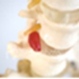 Lindstrom Chiropractic Clinic - Chiropractors in Aurora