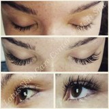 Lotus Laser Skin Treatments - Hair Removal in Massapequa