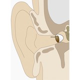 Integrity Hearing Solutions - Hearing Aid Providers in Mechanicsburg