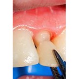 Horvath Family Dentistry - Dentists in Pittsburgh